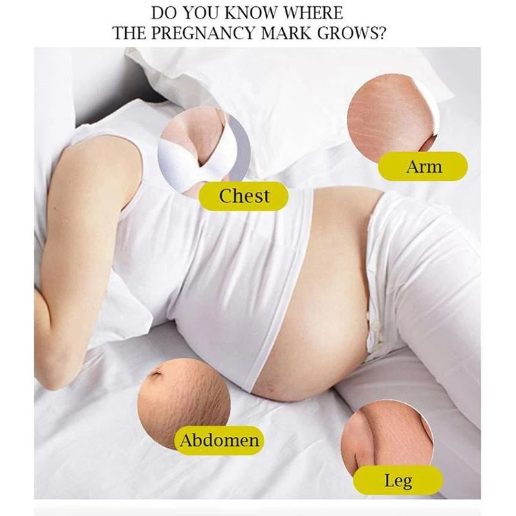 belly stretch marks removal cream belly stretch marks removal cream