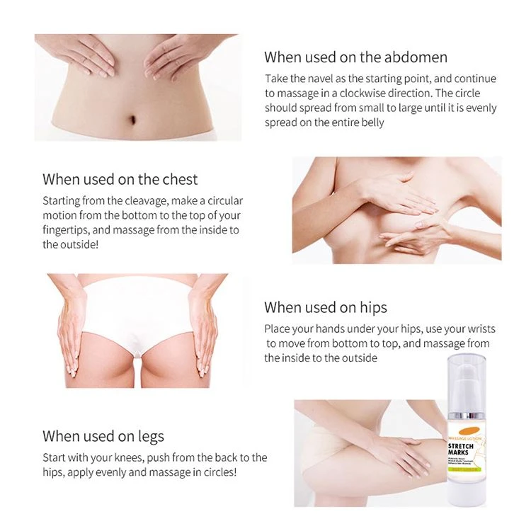 scar stretch mark cream